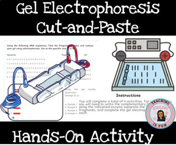 Preview of Gel Electrophoresis Biotechnology Hands-on Activity Principles of Biomedical