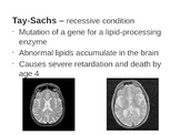 Genetic Disorders