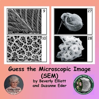 Microscope Image Guessing Game #1 - Scanning Electron Microscope Images - SEM