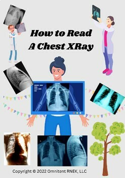 Preview of How to Read a Chest X-Ray Just Like a Radiologist Physician! STEM Majors