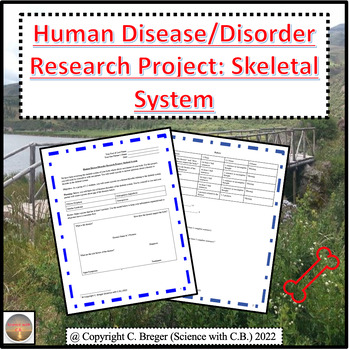 Preview of Human Disease/Disorder Research Project: Skeletal System