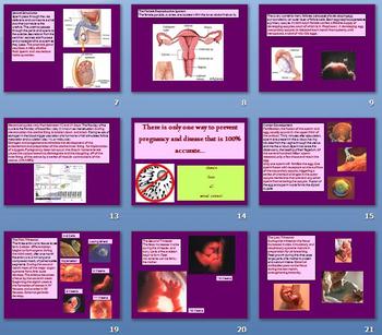 Preview of Human Reproduction, Development, STIs, Contraception - Power Point - Keene