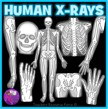 Preview of Human X-Ray Realistic Clip Art