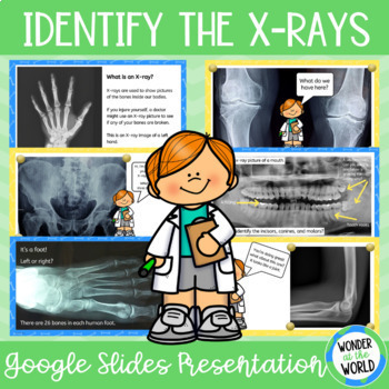 Preview of Human skeleton identify the X-rays and bones Google Slides slide show activity