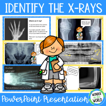 Preview of Human skeleton identify the X-rays and bones PowerPoint slide show activity