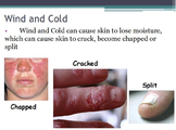 Hygiene - Skin Protection w/worksheet (SMART BOARD)