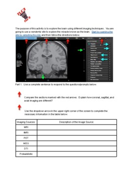 Preview of Imaging the Brain