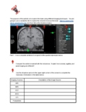 Imaging the Brain