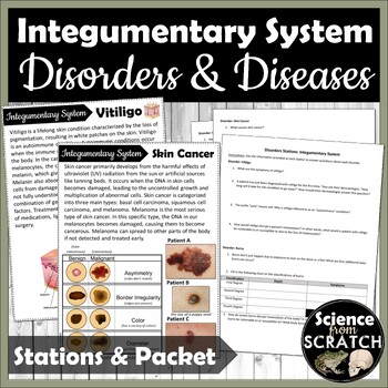 Preview of Integumentary System Disorders and Diseases Stations