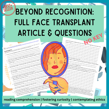 Preview of Face Transplant Article & Questions- NO KEY, Anat/Phys, Integumentary System