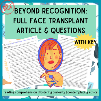 Integumentary System Face Transplant Article With Key Best Seller