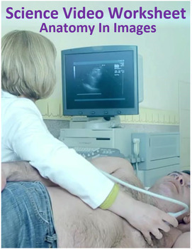 Preview of Intro to Anatomy In Imaging. Video sheet, Google Forms, Canvas, Easel & more. V3