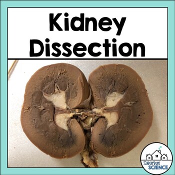 Preview of Kidney Dissection Lab Activity: Urinary System or Excretory System