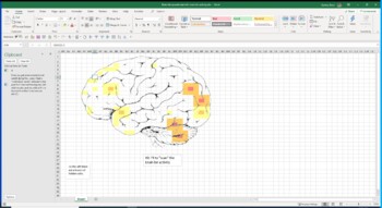 Preview of Lab Brain Scan Analysis Class Activity Psychology Neurology AP Psychology