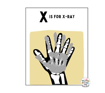 Preview of Letter X Handprint Art Craft Printable Template / Alphabet / X is for X-ray