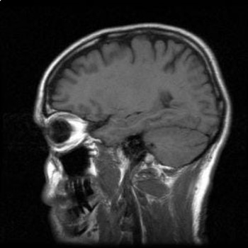 Preview of Magnetic Resonance Imaging