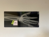 Medical Terminology skeleton identify the bones and X-rays