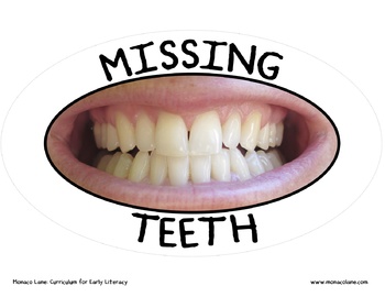 Preview of Missing Teeth Graph