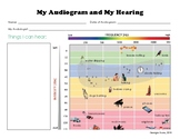 My Audiogram and My Hearing