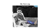 My New Leg: A Child's Amputation Story