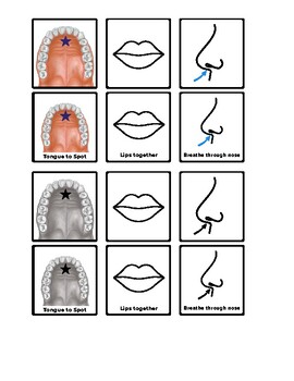 Preview of Myofunctional Therapy Desk Visuals - OMT