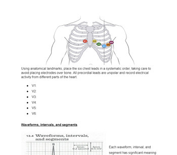 Preview of NHA CCMA Chapter 13 EKG and Cardiovascular Testing Notes