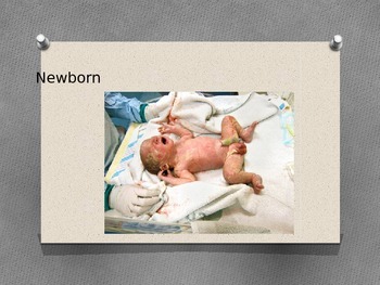 Preview of Newborn Infant Power Point and Student Notes, Answers to Notes