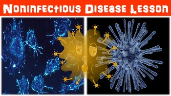 Preview of Noninfectious Disease No Prep Lesson with Power Point, Worksheet, and Activity