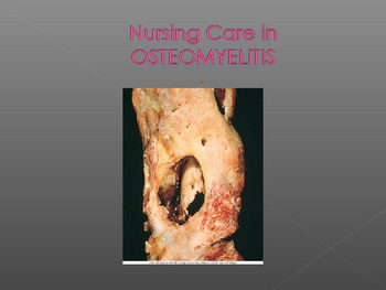 Preview of Osteomyelitis Nursing Care