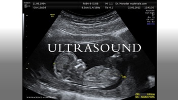 ultrasound teaching resources teachers pay teachers