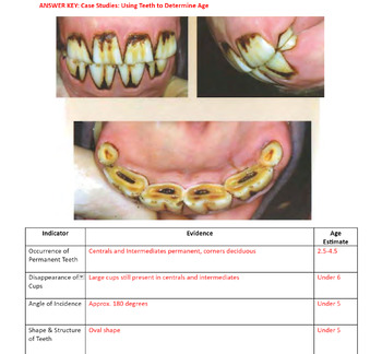 Preview of Practice: Aging a Horse by their Teeth