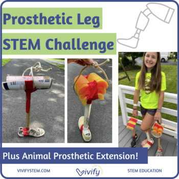 Preview of Prosthetic Leg Engineering Design STEM Challenge