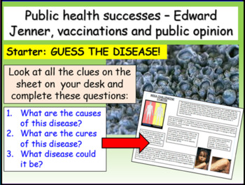 Preview of Public Health - Smallpox, Jenner + Vaccinations