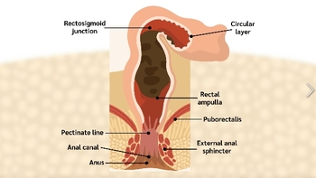 Preview of RECTUM AND ANAL CANAL