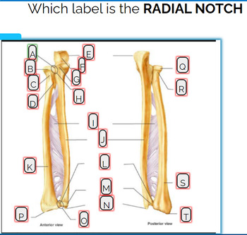 Preview of Radius and Ulna Labeling Boom card