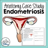 Patient Case Study for Female Reproductive System - Endometriosis