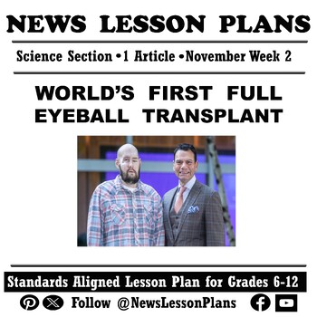 Preview of Science_Eyeball Transplant Breakthrough_Current Events Article Reading_2023