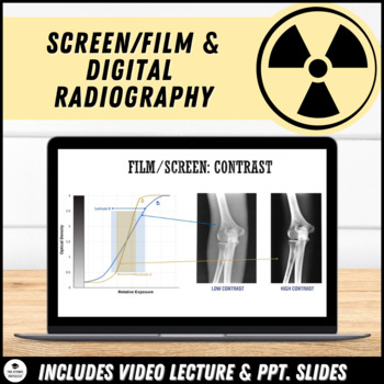 Preview of Video Lecture: Screen & Film, Computed and Digital Radiography