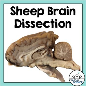 Preview of Sheep Brain Dissection Lab: Structures & Functions of the Central Nervous System