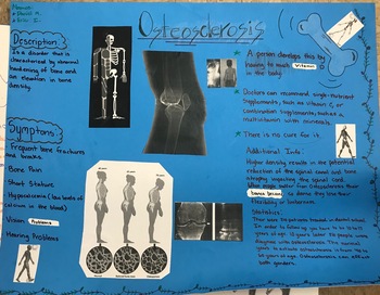 Preview of Skeletal Disorders Project