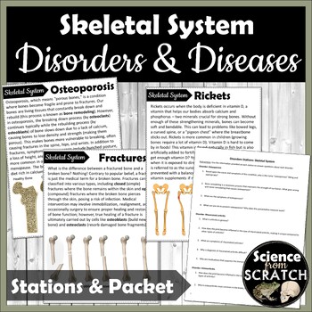 Preview of Skeletal System Disorders and Diseases Stations