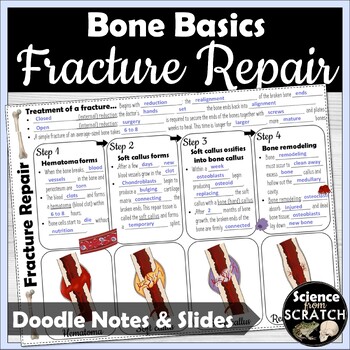 Preview of Bone Fracture Repair Doodle Notes and PPT Slides | Skeletal System | Anatomy