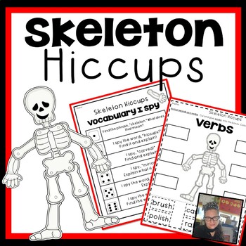 Preview of Skeleton Hiccups Comprehension Activities