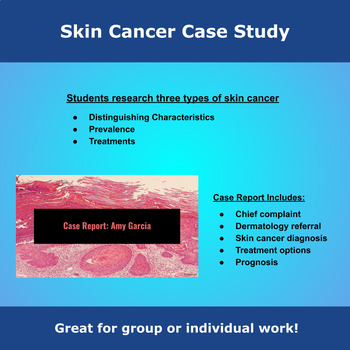 Preview of Skin Cancer Case Study