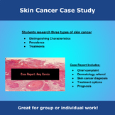 Skin Cancer Case Study
