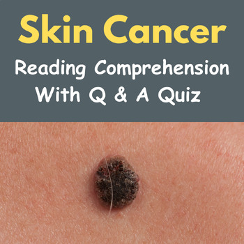 Skin Cancer : Reading Comprehension with Questions & Answers Quiz