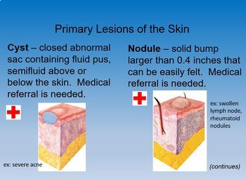 Skin Disorders & Diseases PowerPoint Notes - Cosmetology Science