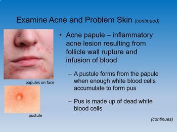 Skin Disorders & Diseases PowerPoint Notes - Cosmetology Science