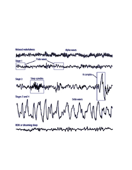 Preview of Consciousness: Sleep Stages and EEG Practice