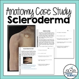 Student Case Study for Integumentary System - Disorder of 